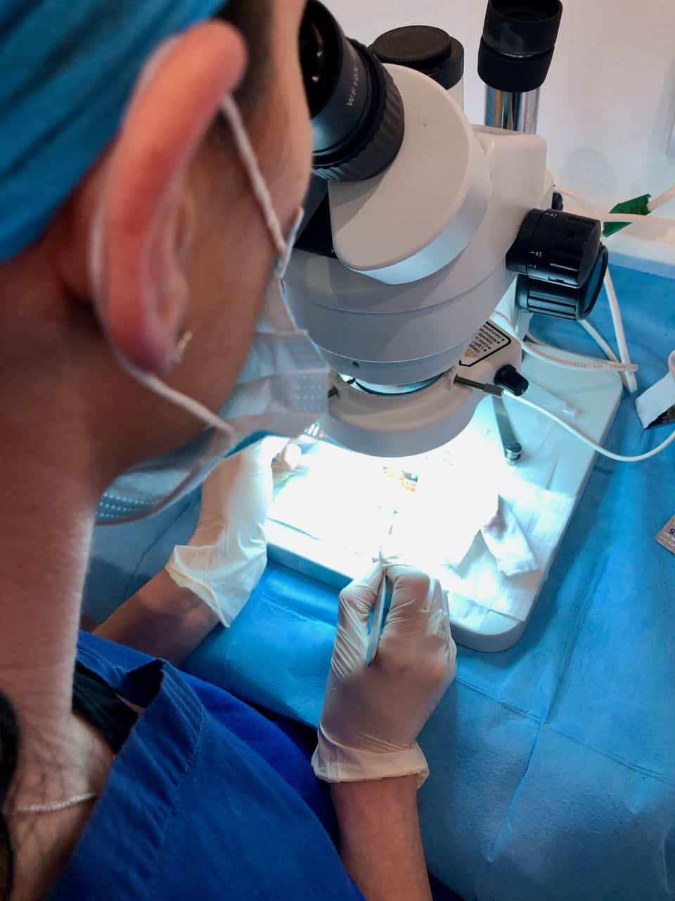 afro eyebrow transplant cutting