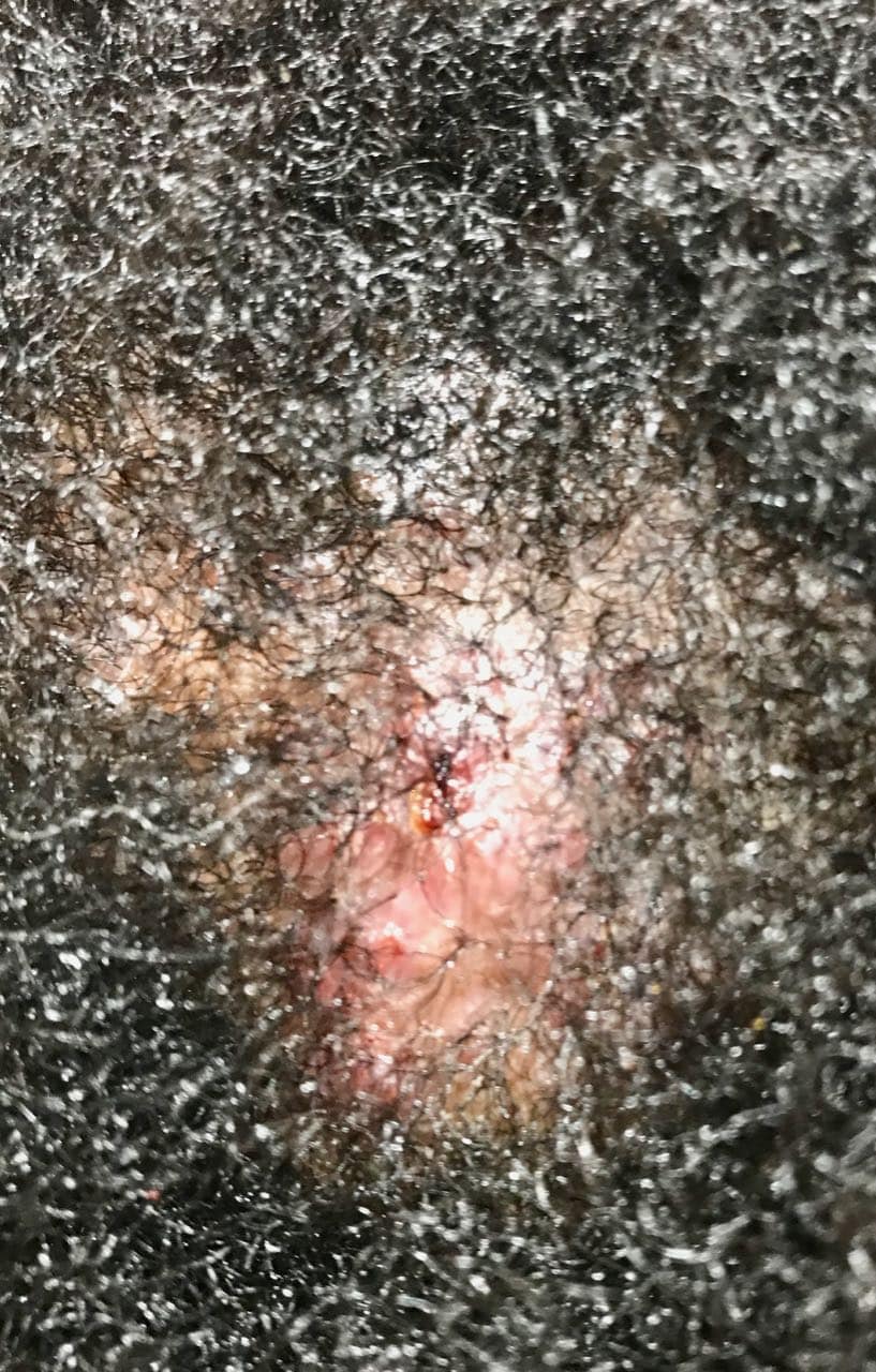 afro scalp our clinic