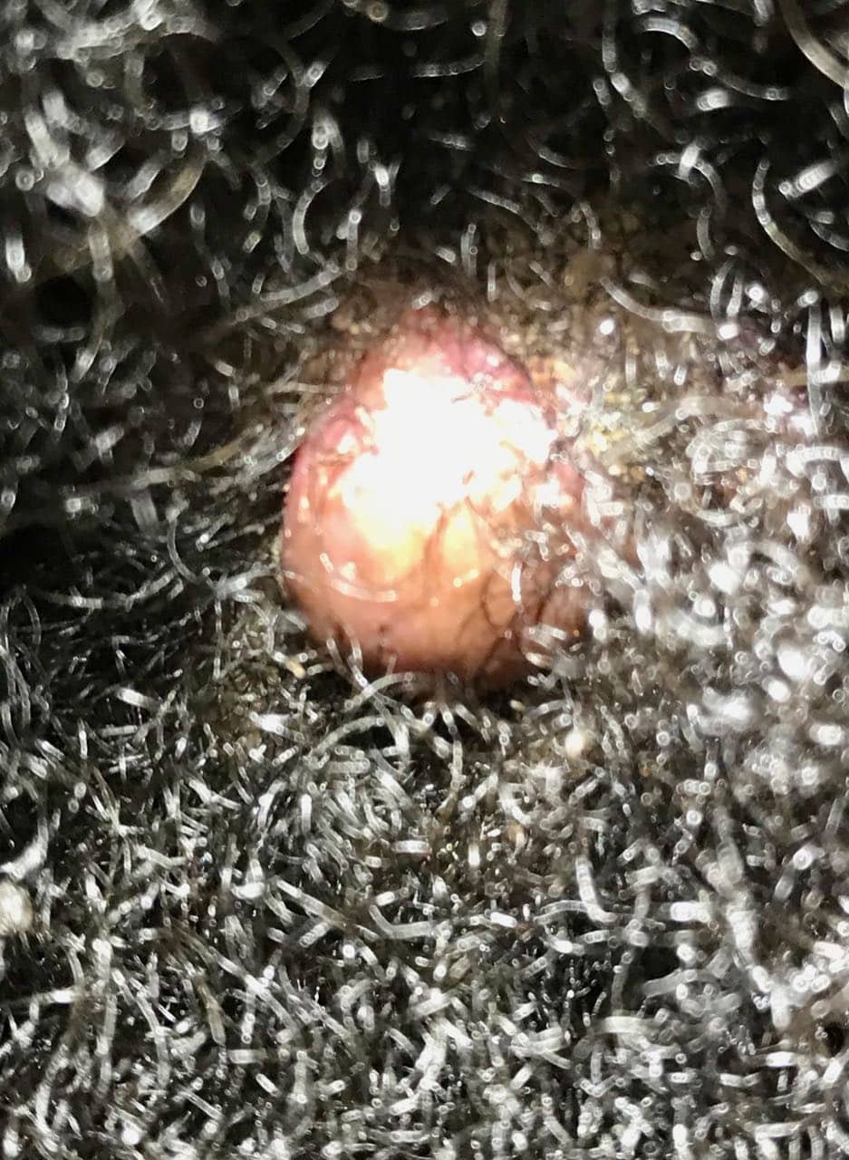 afro scalp spot