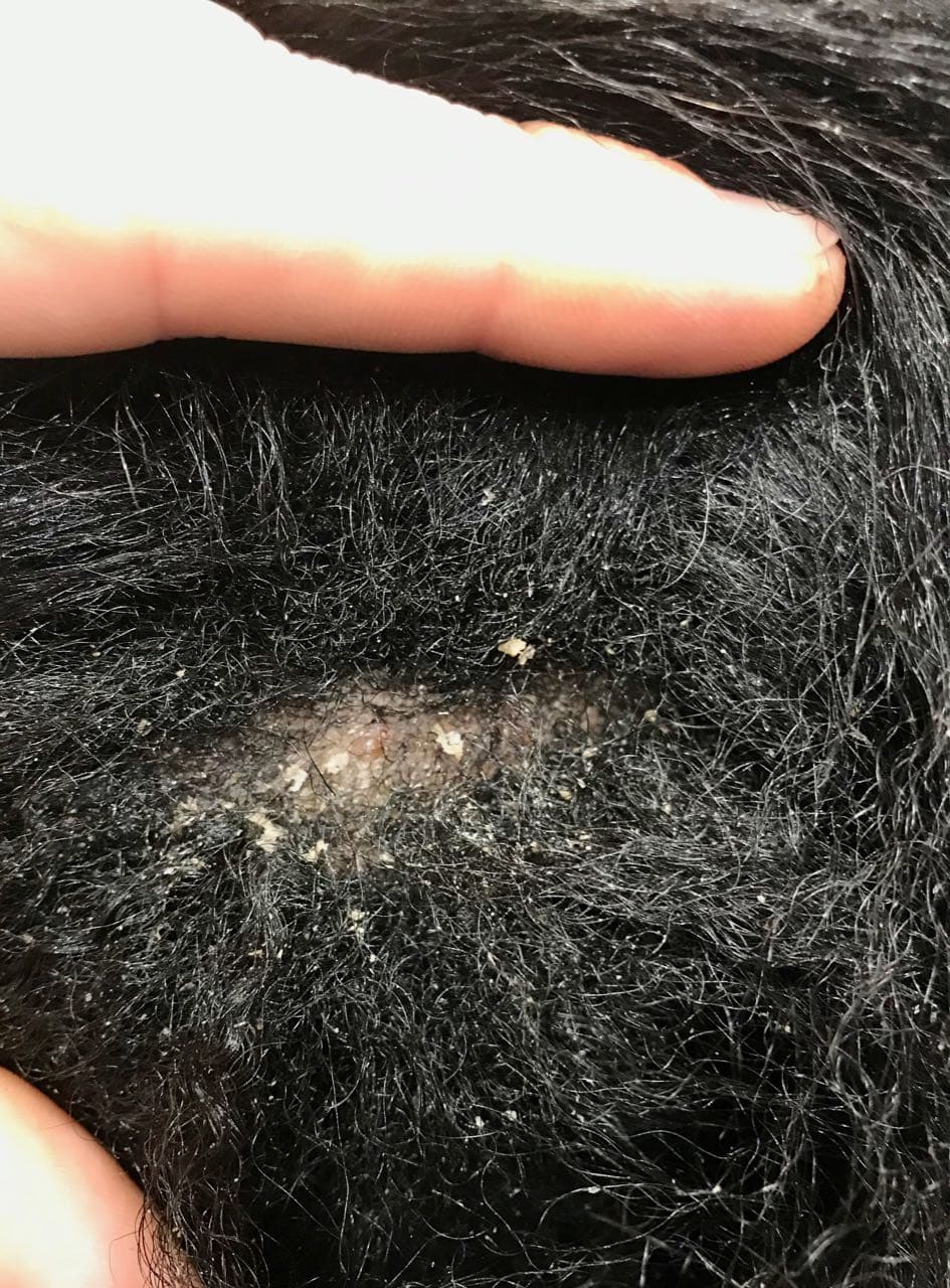 afro scalp cleansing occiput