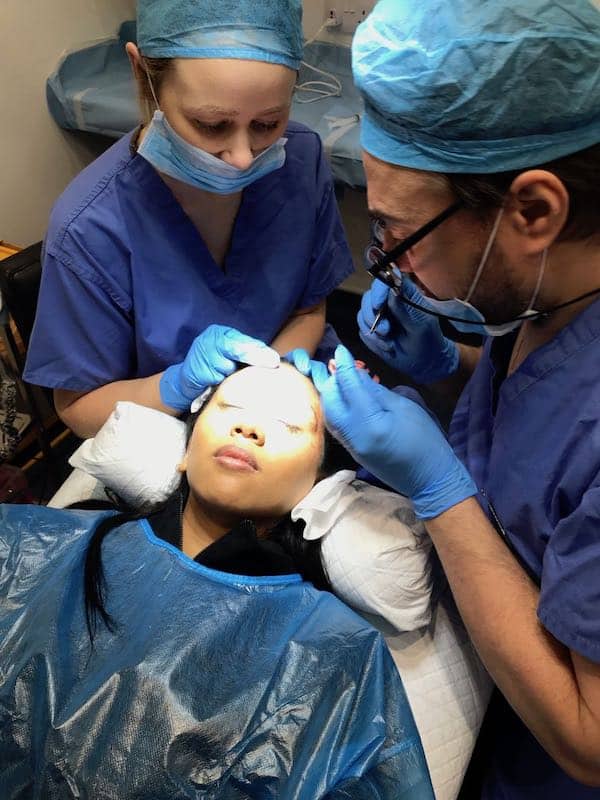 brow lift by maloy 2