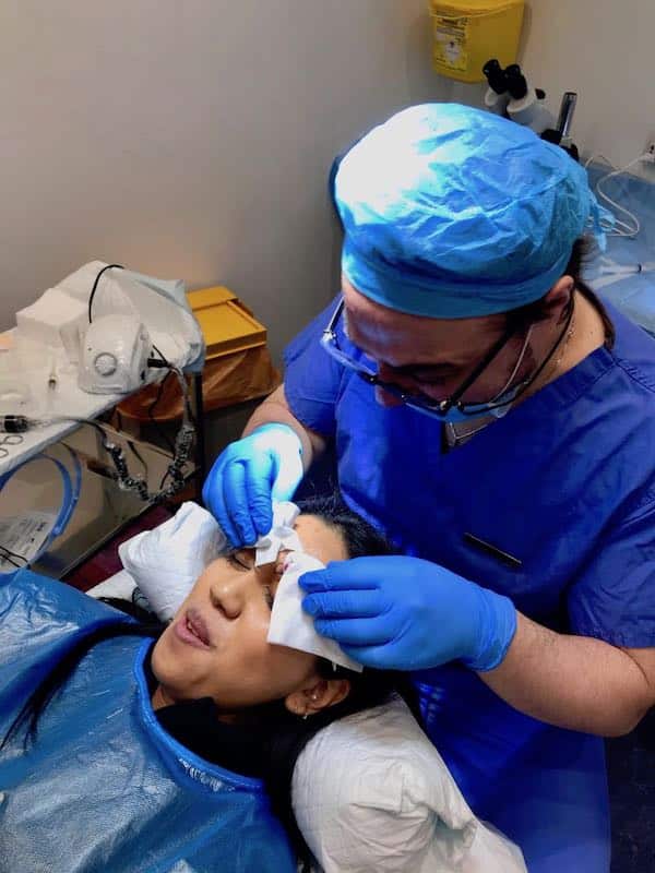 brow lift by maloy 1