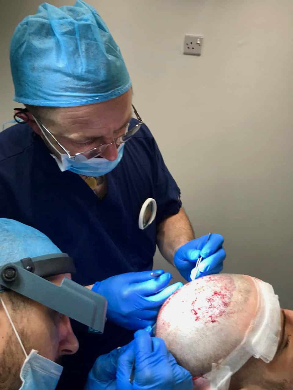 fue fut transplant planting