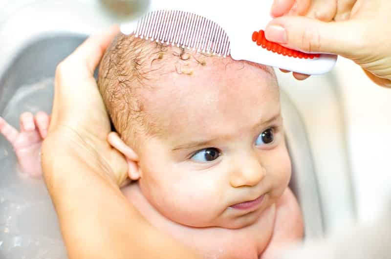 child scalp conditions