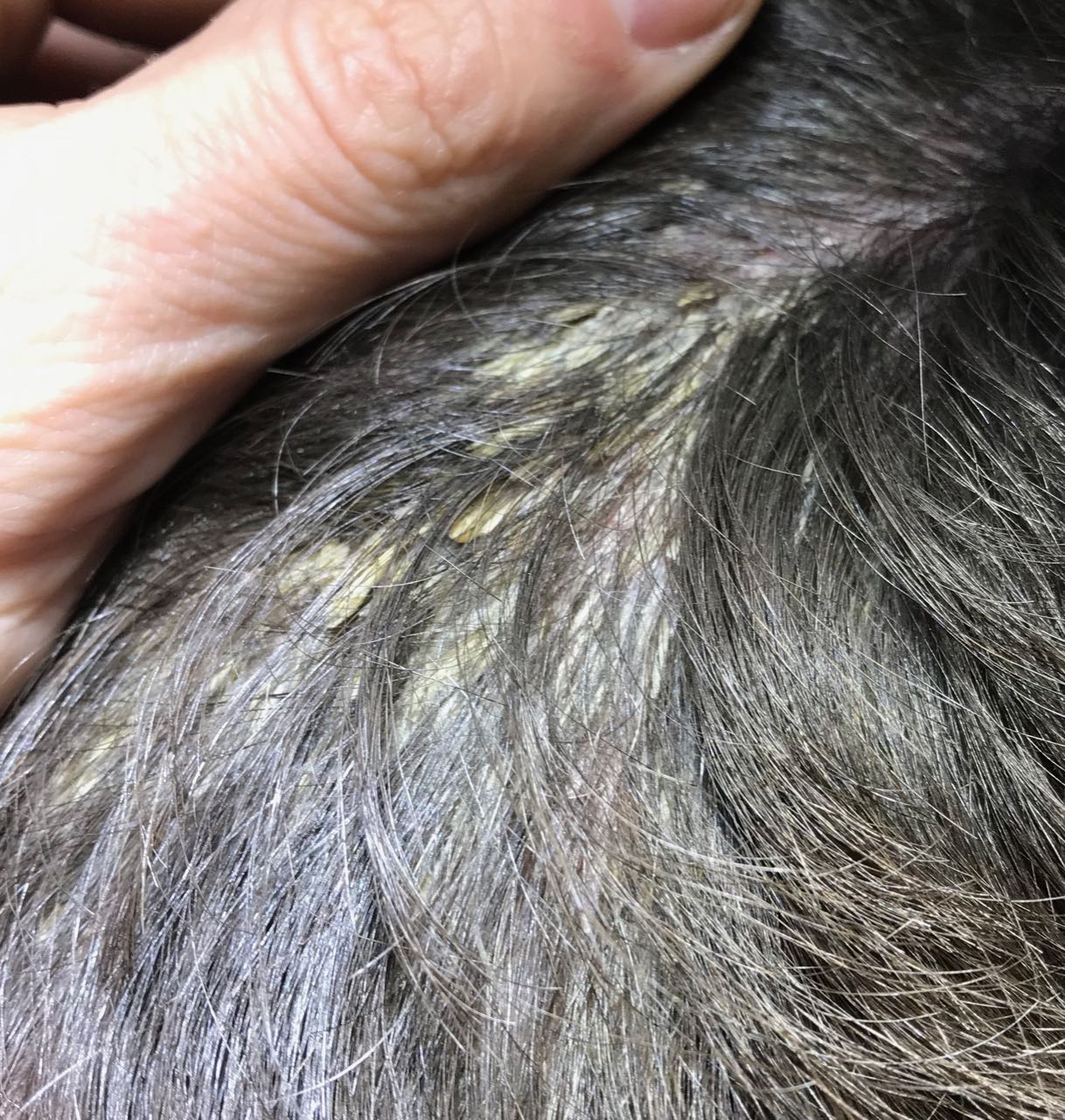 Scalp Psoriasis | Itchy Scalp | Dry Scalp | Scalp Crusting Scalp Psoriasis | Itchy Scalp | Dry Scalp | Scalp Crusting