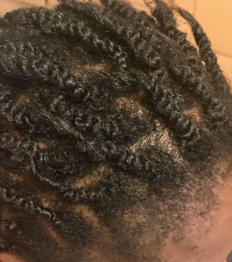 Afro Scalp Cleansing Remove the itchy dry flaky scalp